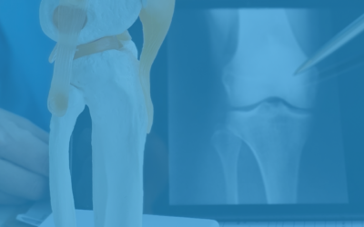 Ortepedia e Plantari sportivi