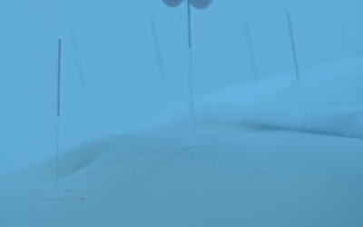 Agopuntura e Omeopatia