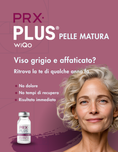 prx plus in valle camonica
