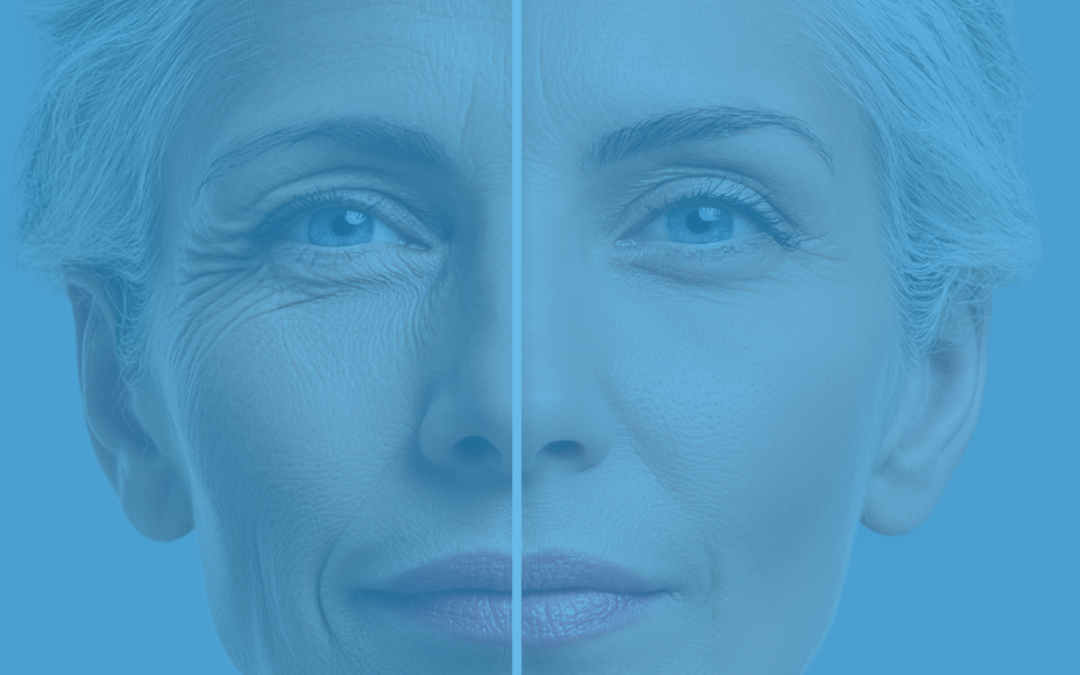 Sublimazione dermica darfo boario terme